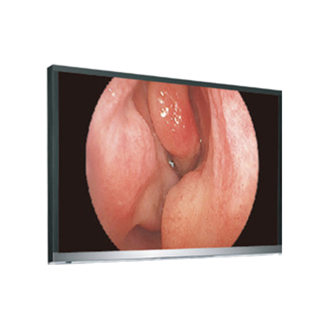 Monitor LCD 4K UHD