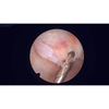 Artroscopio de 2.7 mm